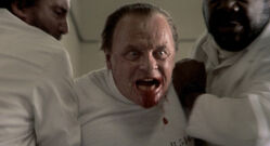 Hannibal crazy face