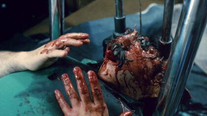 Dennis head crushed