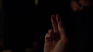 Mary Sibley's burned fingers
