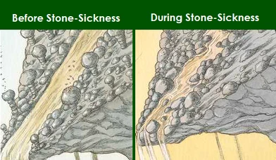 Stone Sickness