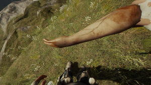 The player blocking with an Arm.