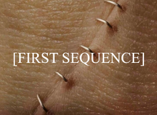 First Sequence