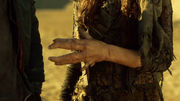 Emori's deformed hand.