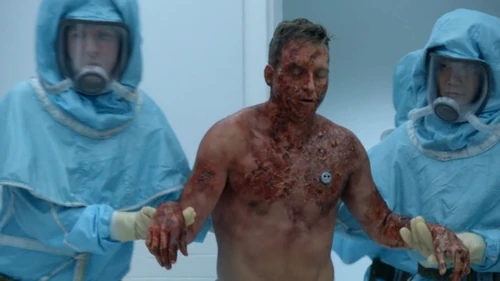 Inclement Weather - Langston before receiving treatment