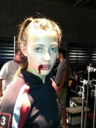 District 3 female's lip having split in training
