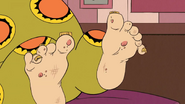 S1E14B Extra toe