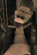 Finklestein close up