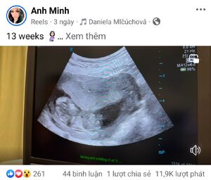AnhMinh-PregnancyOf5thChild-2024