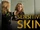 Sensitive Skin (2014)