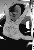 Amon's deformed hand.