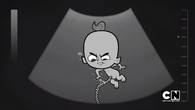 Dunc inside womb