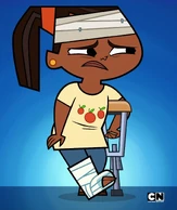 Leshawna pretends that she's very injured.