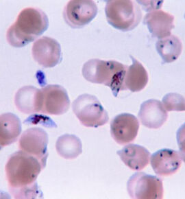 Plasmodium