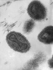 Smallpox virus virions TEM PHIL 1849-2-