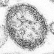 595px-Measles virus.jpg