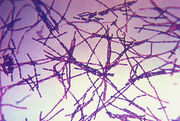 Anthrax.jpg