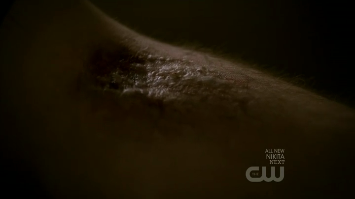 Werewolf Bite