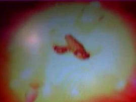 "I am going to hide in my aura, people will think I'm the sun"