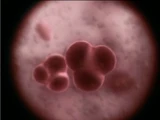 Corvinus Strain