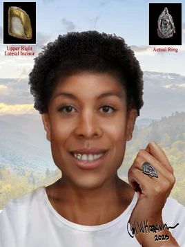 UP113496 Little Bit Koppelman Reconstruction