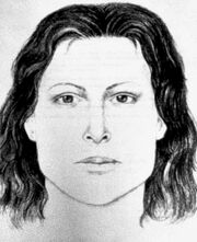 Reconstruction