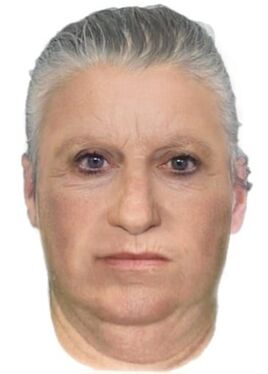 MPJD reconstruction