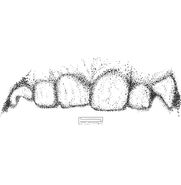 Dental approximation
