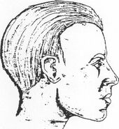 Earlier reconstruction