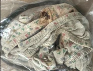 Jackson County Jane Doe, Mississippi