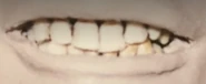 Close-up of teeth