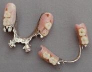 Dentures