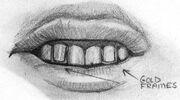 Garden Grove teeth