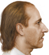 Reconstruction without beard