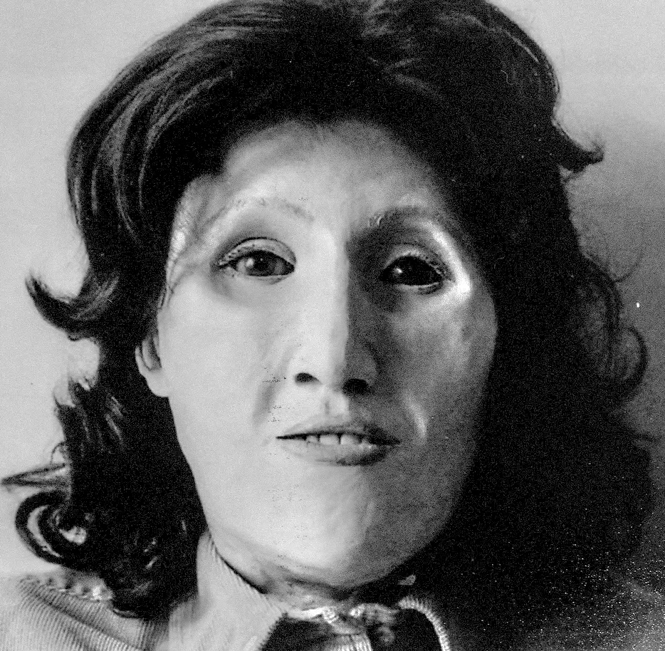 Autauga County Jane Doe (1986) | Unidentified Wiki | Fandom