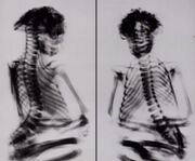 X-rays of mummy