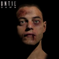 Josh injured model by Austin Martin