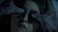 Emily's eyes perforated by Hannah (Wendigo).
