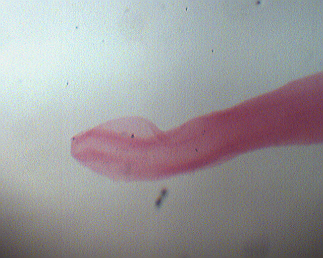 diphyllobothrium latum