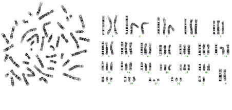 G-banding chromosome chart