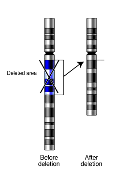 Full plaid - Wikipedia