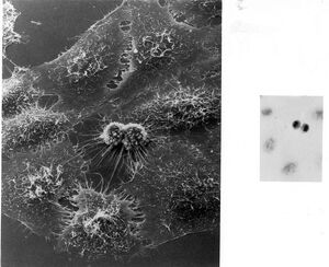 739px-Hela Cells Image 3709-PH