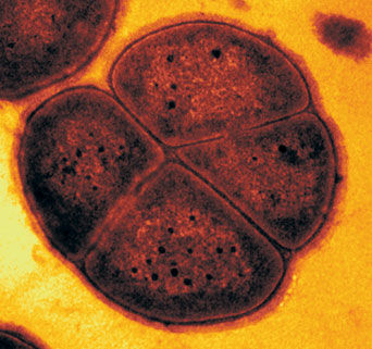 Deinococcus radiodurans - Wikipedia