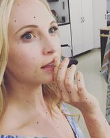 Candice King August 11, 2016