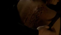 TVD212-019~Rose-Werewolf Bite.png (1.4 MB)