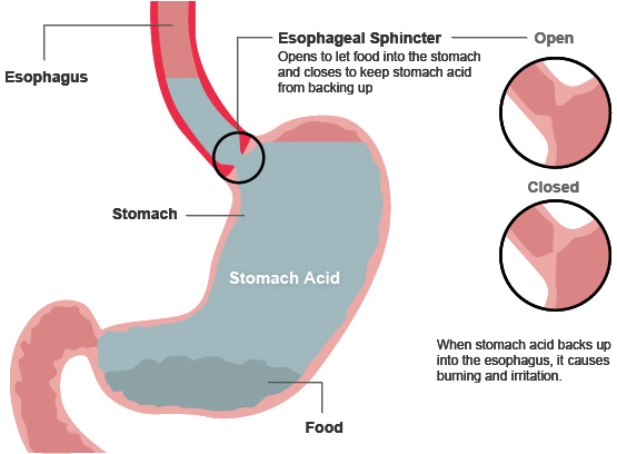 Gastric and back girdle pain does not develop due to physiological changes, the