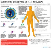 HIV AIDS