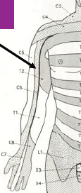 Dermatome.png