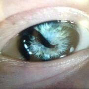 Sigurd's eye, which gave him his name.