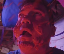 Will, stung by bees.