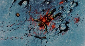 Ackland's partially eaten corpse.